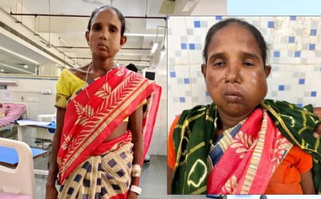रायपुर: संजीवनी बना मेगा सुपर स्पेशलिटी हेल्थ कैंप, बुधरी मड़कम को मिला नया जीवन
