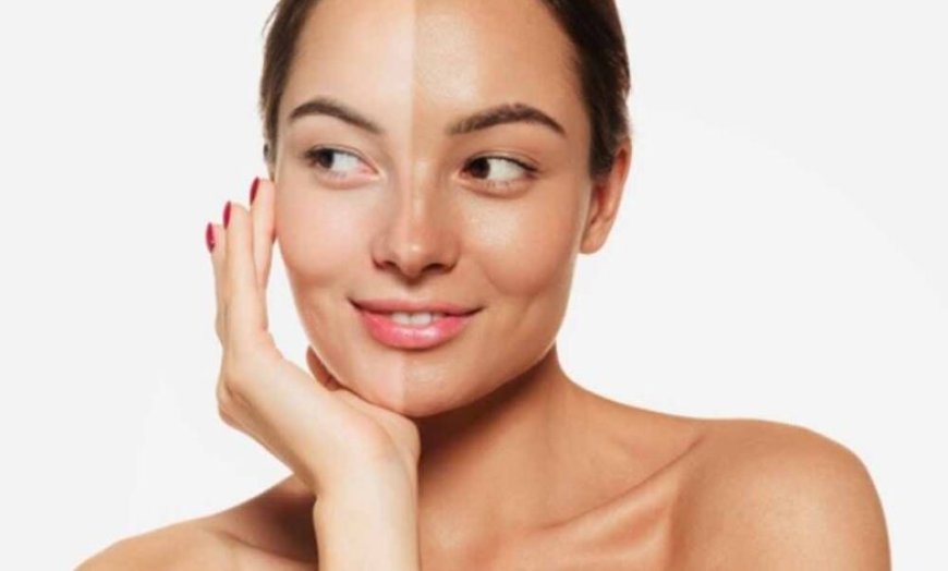 टैनिंग हटाने के 5 आसान घरेलू नुस्खे, मिनटों में पाएँ चमकती त्वचा