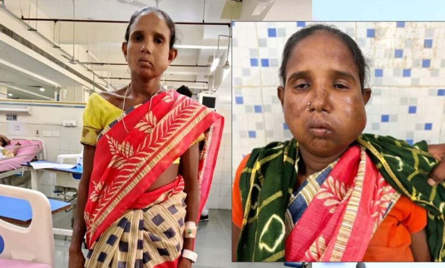 रायपुर: संजीवनी बना मेगा सुपर स्पेशलिटी हेल्थ कैंप, बुधरी मड़कम को मिला नया जीवन