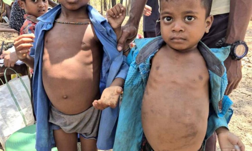 घने जंगलों और नदी-नालों को पार कर स्वास्थ्य दूतों ने बचाई दो मासूमों की जान