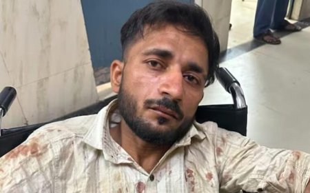 UP पुलिस परीक्षा देने जा रही छात्राओं से छेड़छाड़, आरोपी ऑटो ड्राइवर पुलिस एनकाउंटर में घायल