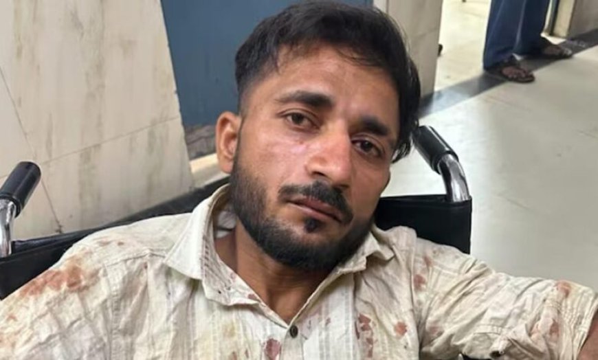 UP पुलिस परीक्षा देने जा रही छात्राओं से छेड़छाड़, आरोपी ऑटो ड्राइवर पुलिस एनकाउंटर में घायल