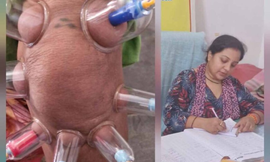 लोहरसी आयुर्वेदिक औषधालय में दर्द प्रबंधन हेतु कपिंग थेरेपी एवं विशेष आयुर्वेदिक उपचार सेवाओं का आरंभ